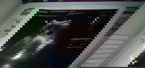 kawatir di USG UK mundur