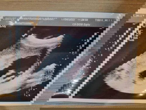 12 week แล้วดวงใจน้อยๆของแม่