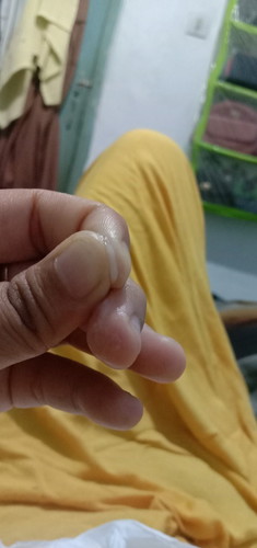 Keputihan hamil 10 minggu