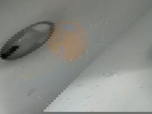 แท้งใช่ไหมคะ