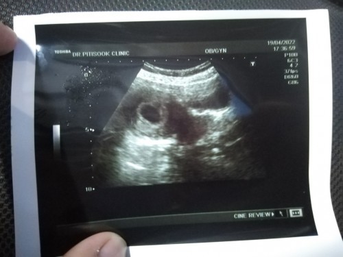 การตั้งครรภ์