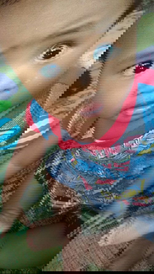 Penyakit apa kaya panu