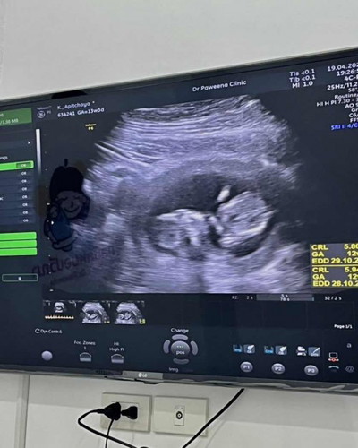 รบกวนแม่ ๆ ช่วยดูหน่อยค่ะ 😂