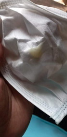 อาการใกล้คลอดหรือป่าวค่ะ