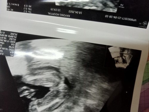 อยากรู้ว่าน้องผู้หญิงหรือชายค่ะ