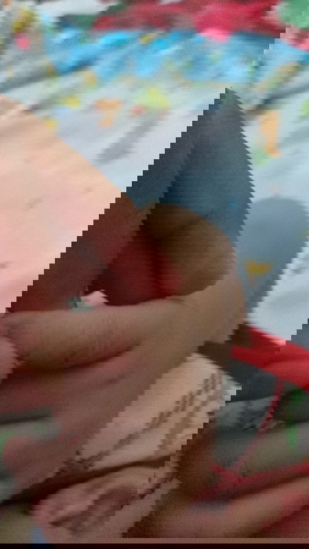 Kaki bayi beruntusan