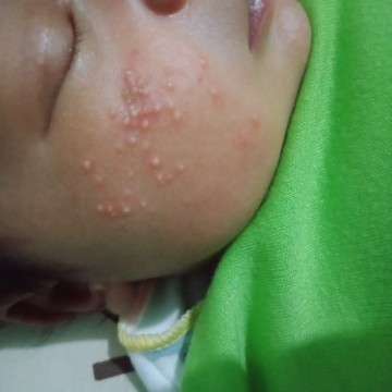 Bayi 2minggu