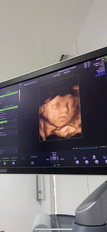 ทีมมิถุนายน มาอวดน้อนกันค้าาา