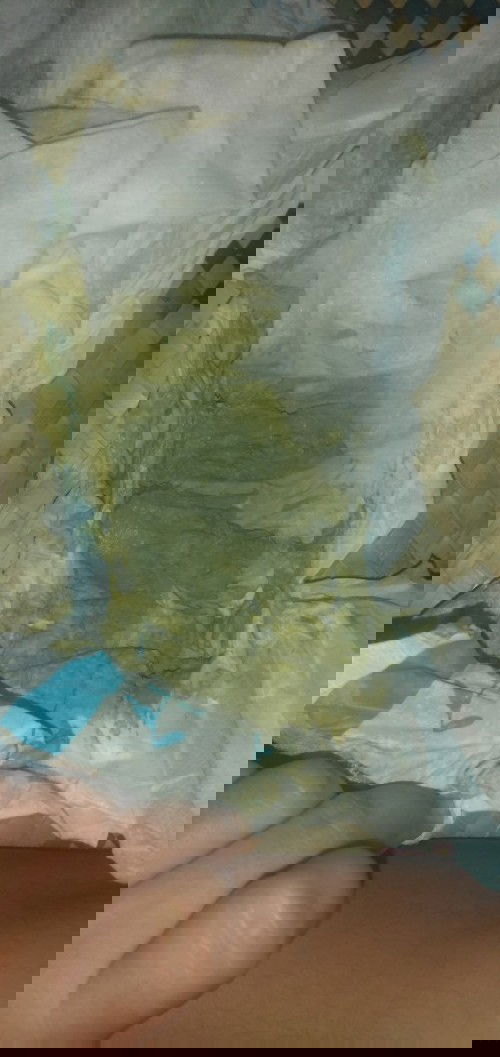 Concern for babies poop