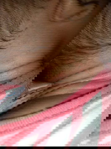 Kulit  leher bintik kemerahan