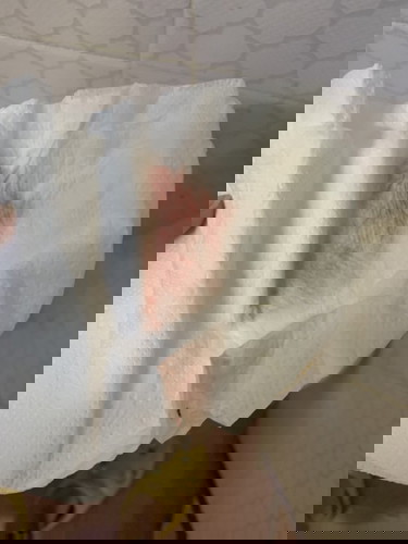 สอมถามๆแม่ๆค่ะ เพิ่งตรวจว่าตัวเองตั้งครรภ์ แต่ยังไม่ได้ไปฝากครรภ์ เนื่องจากอยุ่ในการรักษาตัวโควิด เมื่อวานเจอเลือดออกแบบนี้ อันตรายมั๊ยคะ