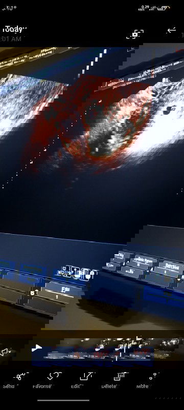 My baby's ultrasound 😻😻😻😻😻