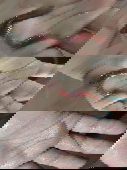 Kluar lendir darah, lebih dari HPL nya blm lahir-lahir...