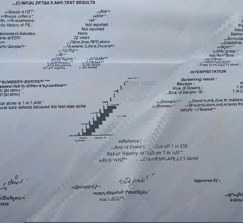 ตรวจพบว่าเสี่ยงดาว์นซินโดรมสูง
แม่ๆขอคำชี้แนะที่ค่ะ
