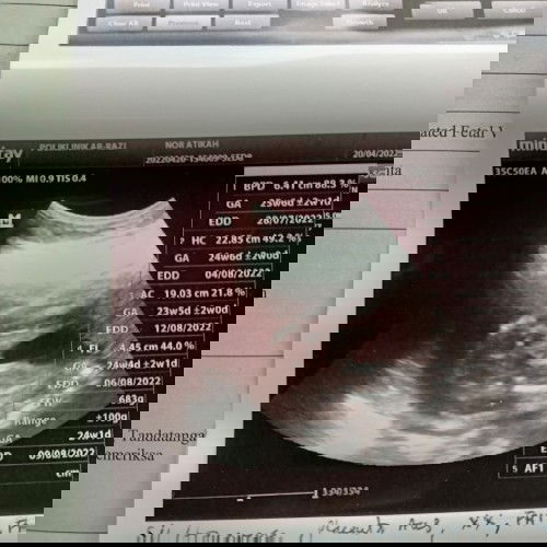 gender boy or girl .