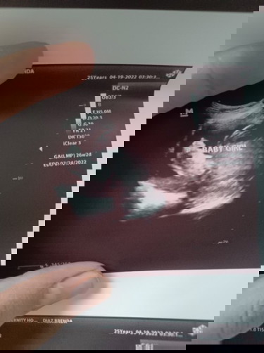 26 pregnant and it's a Girl