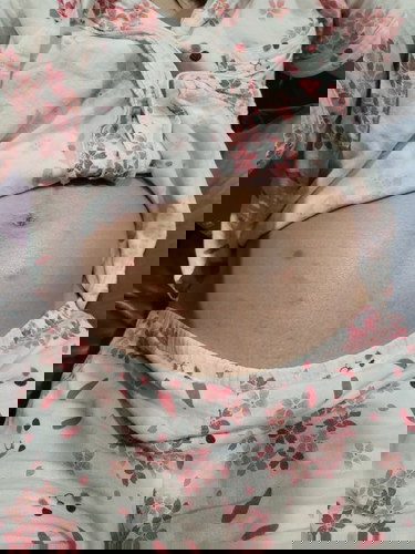 มีแม่ๆคนไหนผื่นขึ้นแบบนี้บ้างมั้ยคะ