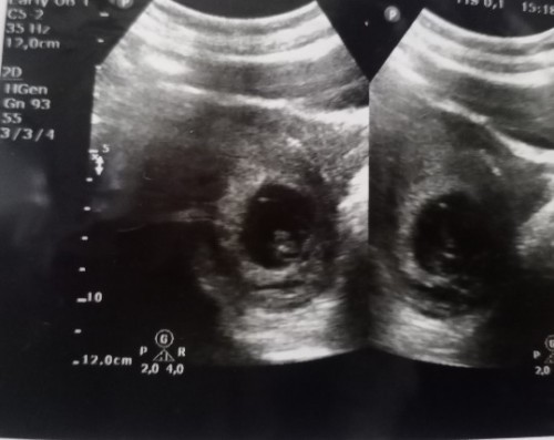 8 week sehat selalu, bismillah