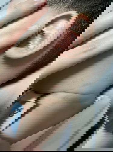 รบกวนแม่ๆดูผื่นอะไรรักษายังไงคะ