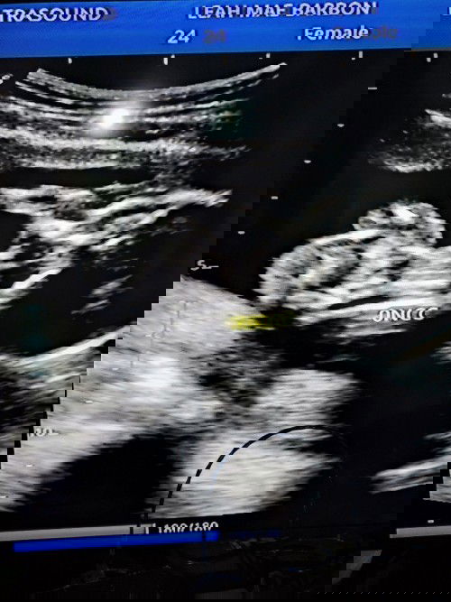 Blessed with a baby Girl 🥰😇