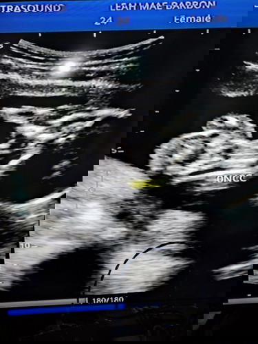 Blessed with a baby Girl ๐ฅฐ๐