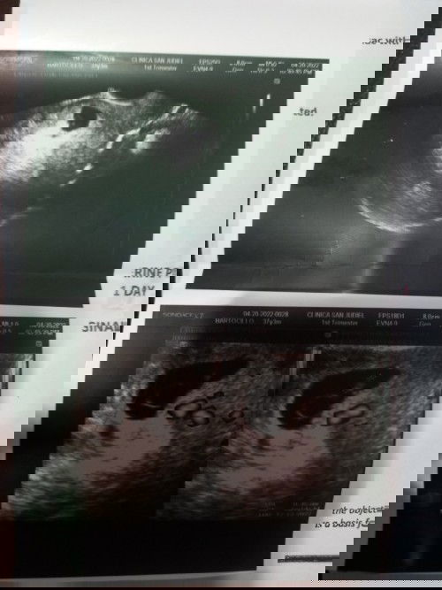 Early Pregnancy Paranoia