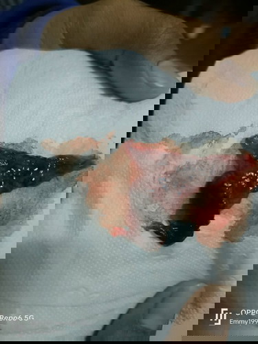 เลือดออกระหว่างตั้งครรภ์