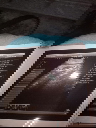 Nanya hasil usg usia kandungan
37 minggu