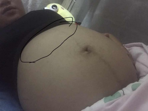 ท้อง 32+5 เจ็บท้องด้านบนใต้ราวนม กังวลมาก แล้วก็กลัวนิดๆ แม่ๆ บ้านไหนเป็นบ้างคะ (ท้องแรก)