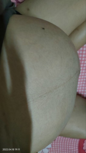 สอบถามแม่ๆค่ะ