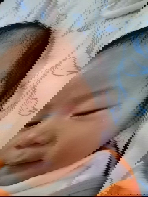 Katanungan tungkol sa parang rashes sa gilid ng mata ni baby