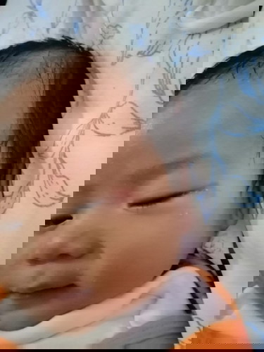 Katanungan tungkol sa parang rashes sa gilid ng mata ni baby