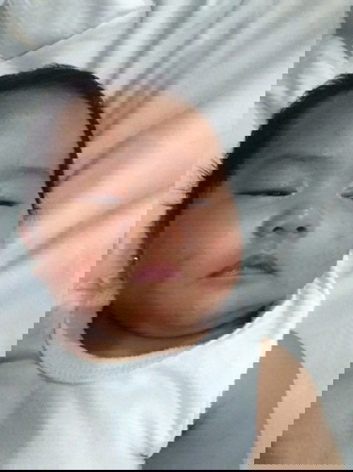 Rashes sa face ng baby