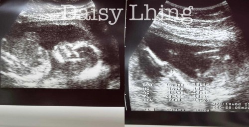 ลูกชายครับ ❤️