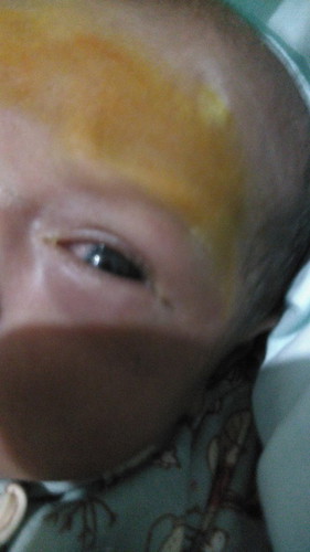 Tolong bagi yg tau. Apa obatnya