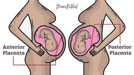 How to Interpret Ultrasound.
Nabasa ko lang rin po ito, hope this helps.