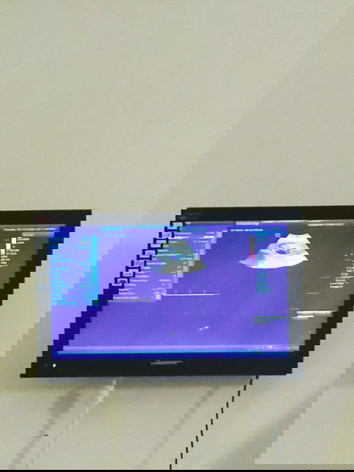 Ano ang maaaring palatandaan kung lalaki ang inyong magiging anak?