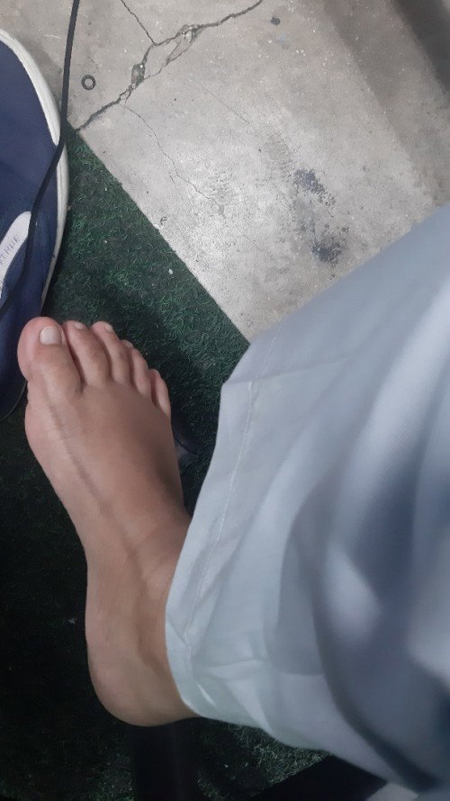 Kaki bengkak
