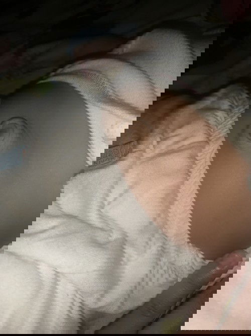 Udel bayi 7 bulan masih bodong