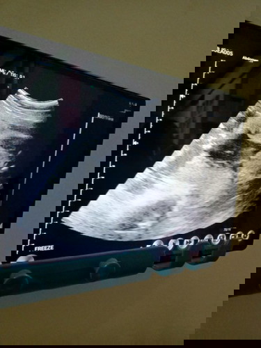 Gender Reveal