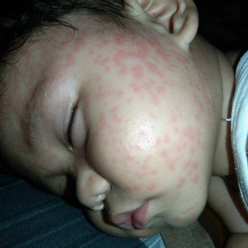 Flu singapure