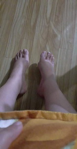 Manas or pamamaga ng paa
