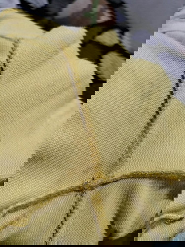 Discharge normal or not?