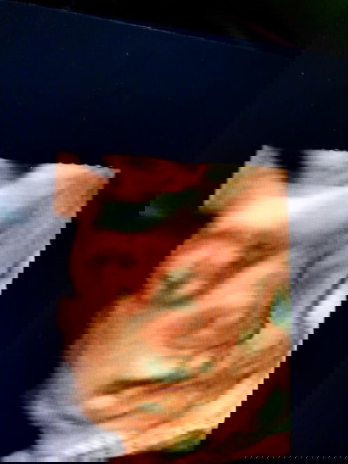 Posisi masih melintang