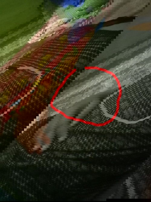 Sakit nyeri di bagian atas pusar