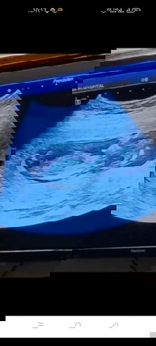 13 Week ชัดเจนขนาดนี้ผู้ชายใช้ไม๊ค่ะแม่ๆ เห็นไวไปไม๊คะ หรือแม่ดูผิด