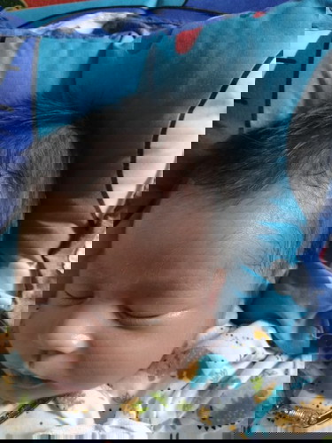 หัวลูกบวมตอนคลอด