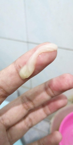 ใช่มูกใสใกล้คลอดไหมคะ