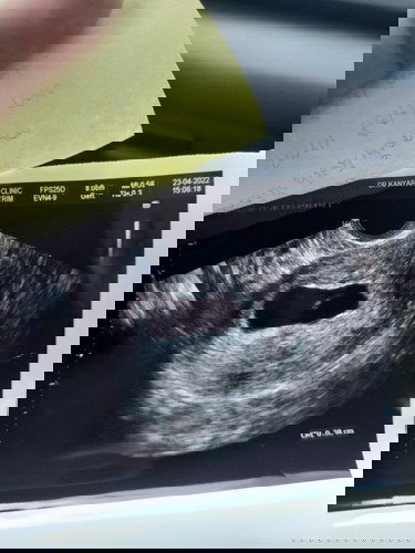 ยุติการตั้งครรภ์