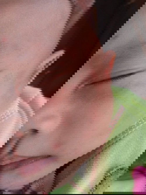 Wajah anak merah merah